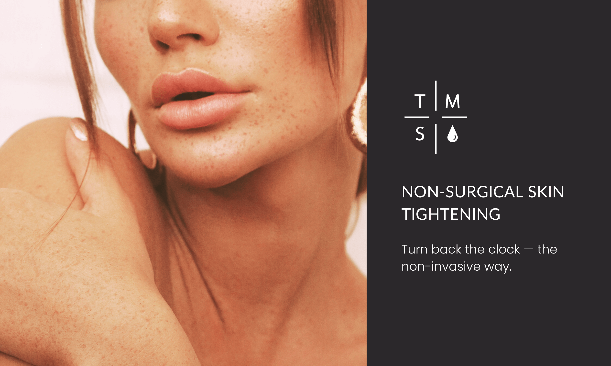 【極美品】Non-Surgical Skin Tightening and Li Non-Surgical Skin Tightening — The Med Spa